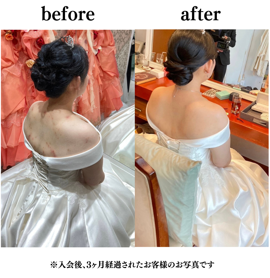 ダウンロード